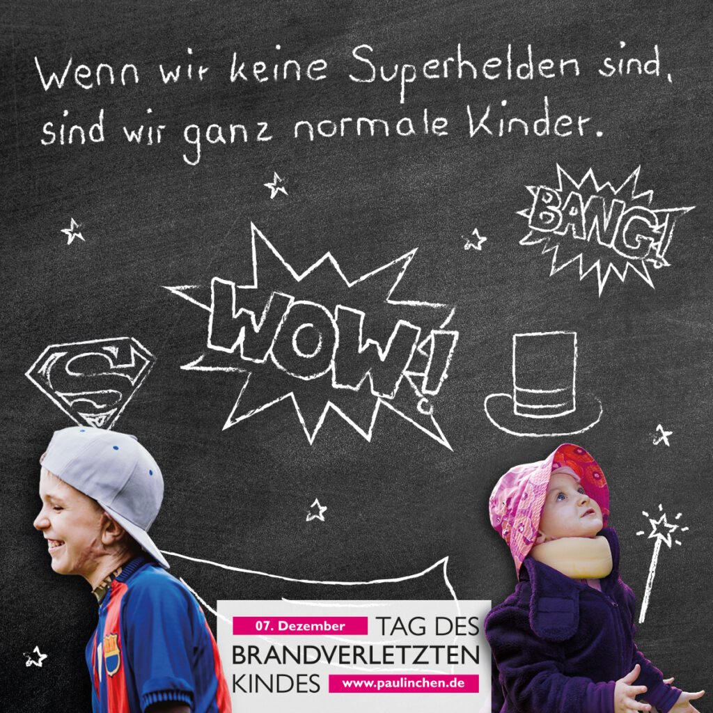 Der „Tag des brandverletzten Kindes“ am 7. Dezember steht in diesem Jahr unter dem Motto „Brandheiß! Brandgefährlich! Brandverletzt!“